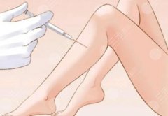 小腿吸脂有什么后遗症吗？适应人群及禁忌症介绍！