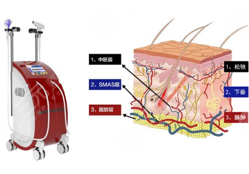 热拉提和热玛吉哪个好？区别有哪些？