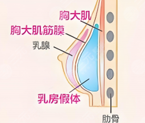 镇江第一医院假体隆胸专家哪个好？技术和口碑均在线