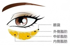 徐州哪家医院做眼袋技术好？口碑实力榜单参考