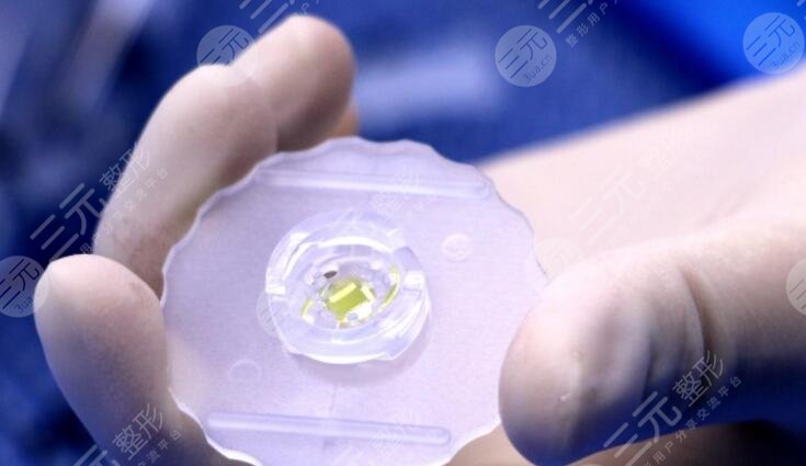 人工晶状体手术