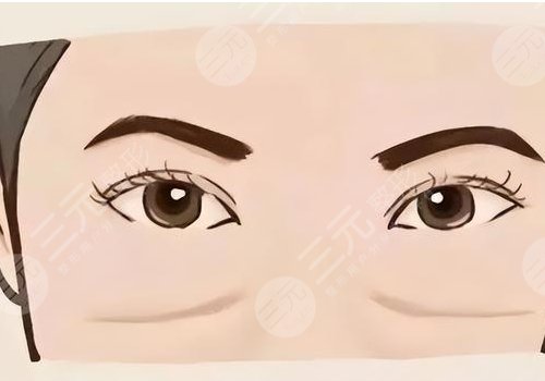 上海九院脂肪填充泪沟多少钱