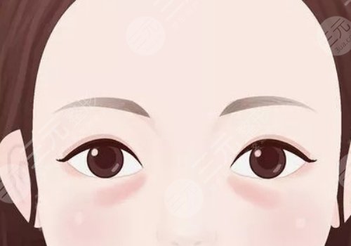 上海九院脂肪填充泪沟多少钱