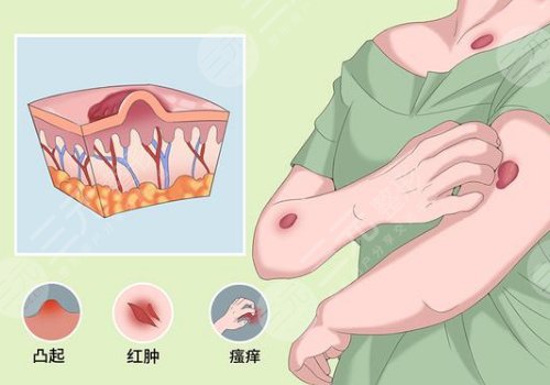 章一新疤痕怎么样