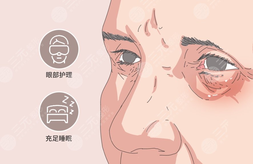 眼袋
