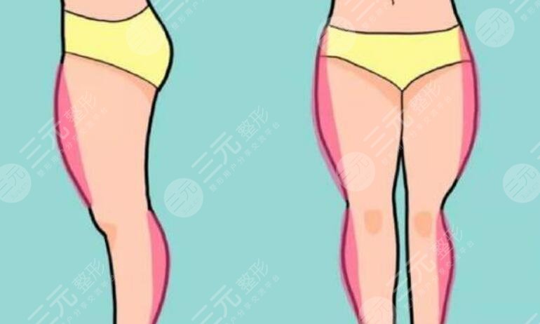钻石超塑溶脂
