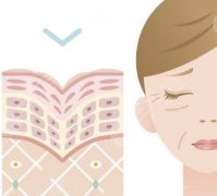 热拉提和热玛吉哪个效果好?区别及作用介绍!戳进来看 热拉提和热玛吉哪个效果好?区别及作用介绍!戳进来看