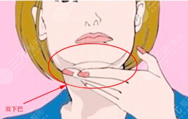 钻石超塑下颌缘