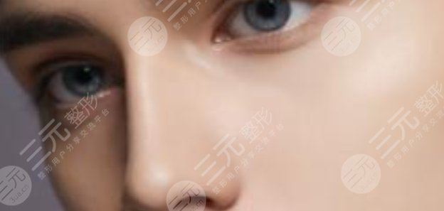 隆鼻