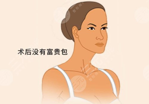 富贵包抽脂手术大概花多少钱?抽脂手术的原理是什么? 富贵包抽脂手术大概花多少钱?抽脂手术的原理是什么?