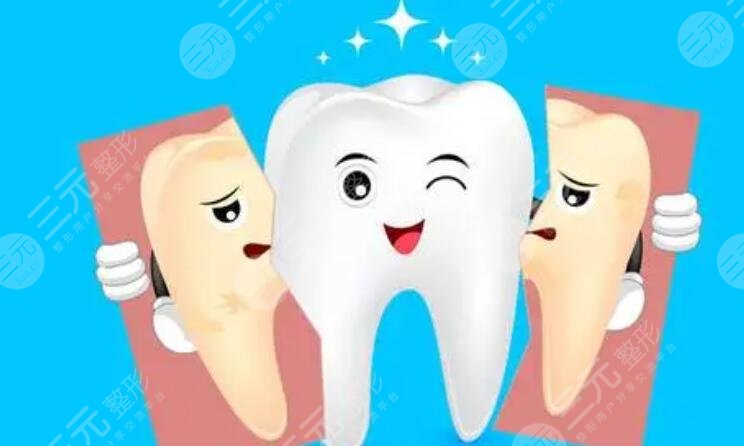 牙齿美白