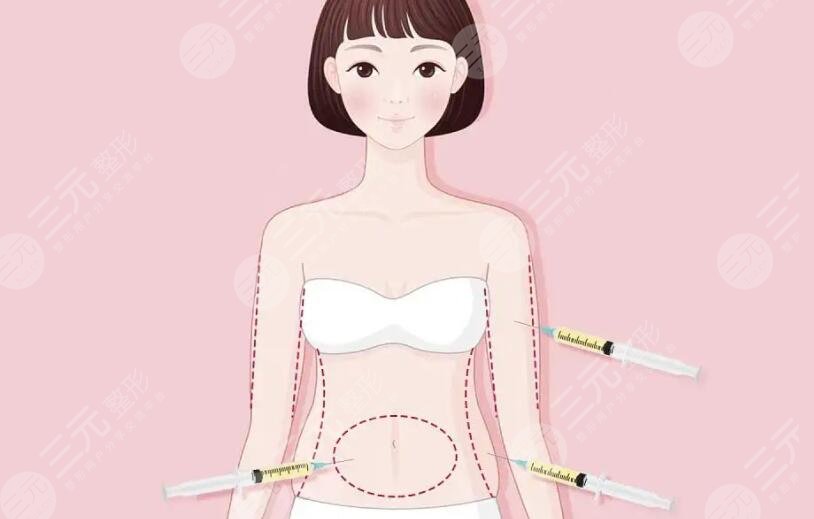 吸脂