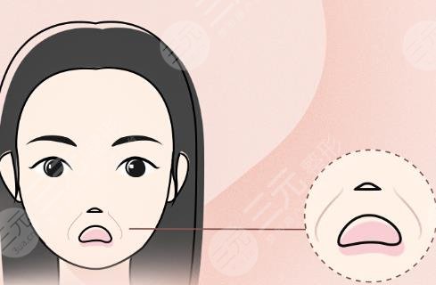 法令纹