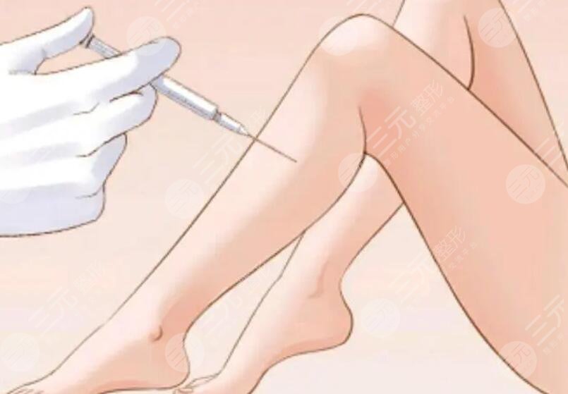 小腿吸脂