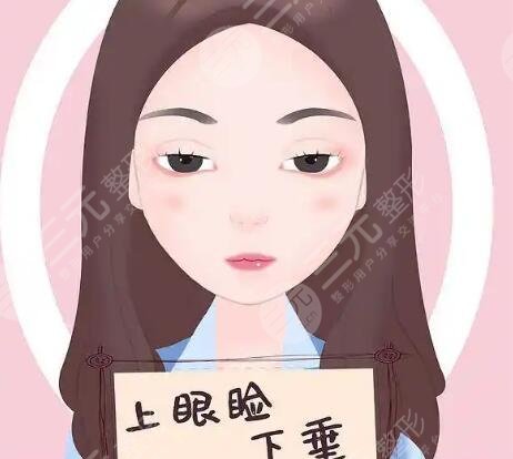 上睑下垂
