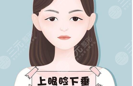 上睑下垂