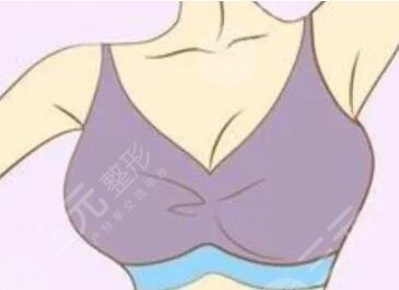 隆胸