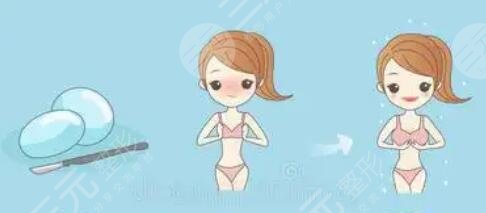 隆胸
