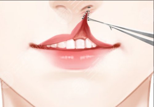 章建林做唇腭裂好吗