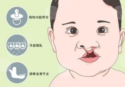 章建林做唇腭裂好吗