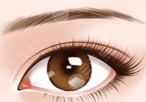 曹卫刚医生双眼皮修复怎么样