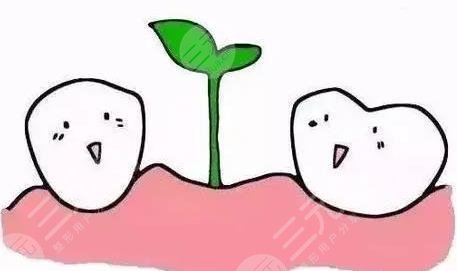 种植牙