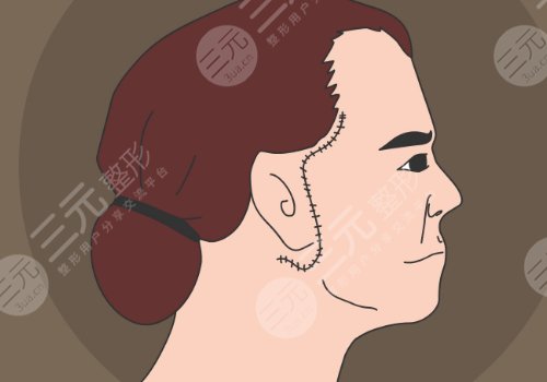 黄广香和魏广运拉皮谁更厉害