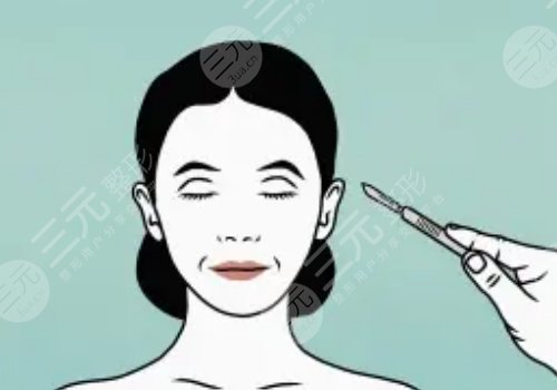 黄广香和魏广运拉皮谁更厉害