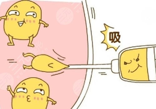 武汉韩辰吸脂怎么样