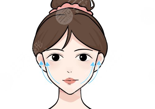 朱自刚无痕筋膜提升怎么样