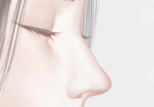 北京蒂凡妮隆鼻好不好