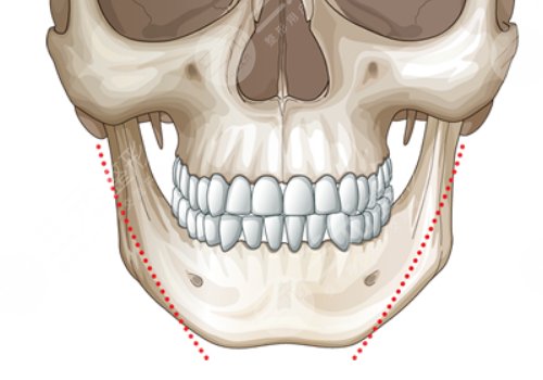 邱立东医生做磨骨整形怎么样
