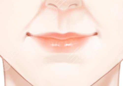 李劲良医生鼻基底是用膨体吗