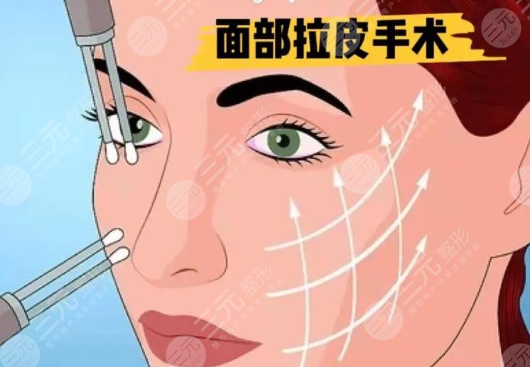 拉皮