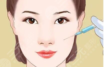 注射美容