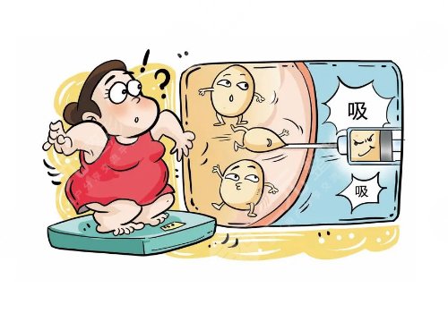 浙一医院抽脂怎么收费