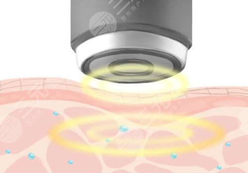 京蒂凡妮医疗王志坚做的提升紧致怎么样