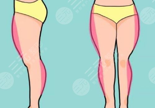 定第一中心医院吸脂多少钱