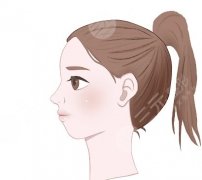 颏成型和正颌哪个风险大？做面部整形后注意事项有哪些？