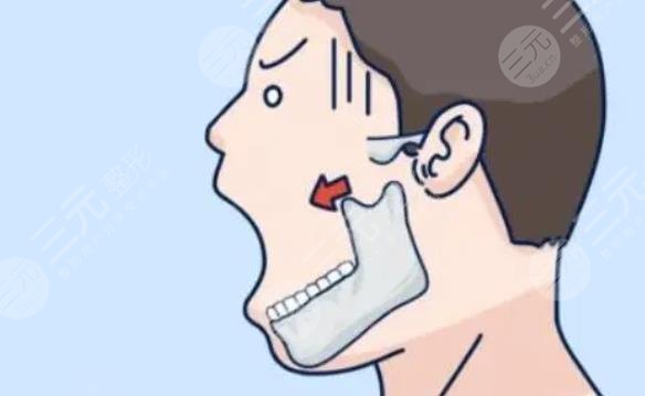 下颌角