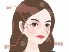 颧骨颧弓手术后遗症有哪些？看完这些你还敢做吗？来看详细介绍