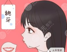 凸嘴矫正后下巴会变长吗？矫正后有哪些风险？费用参考