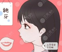 凸嘴手术多久能恢复？有用吗？技术优势剖析！戳进来看