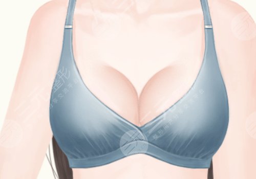 上海九医院徐华和王涛乳房再造哪个好