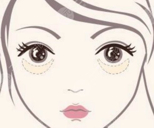 眼袋
