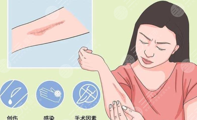 浙大二院整形科王婧技术怎么样?医生信息及擅长项目介绍!-三元整形网