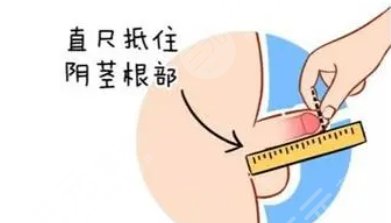 生物补片多少钱生物补片增粗手术多少钱？生物补片增粗手术是什么呢？科普文_https://www.jmylbn.com_品牌排行榜_第4张