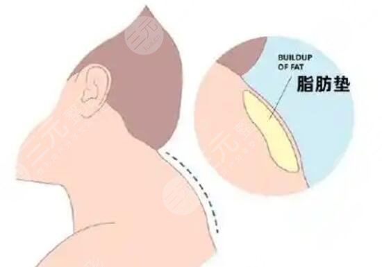 富贵包
