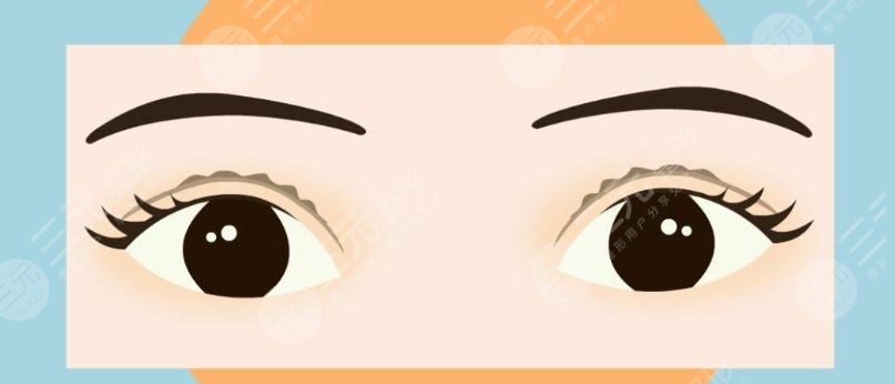 双眼皮
