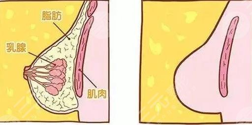 巨乳缩小